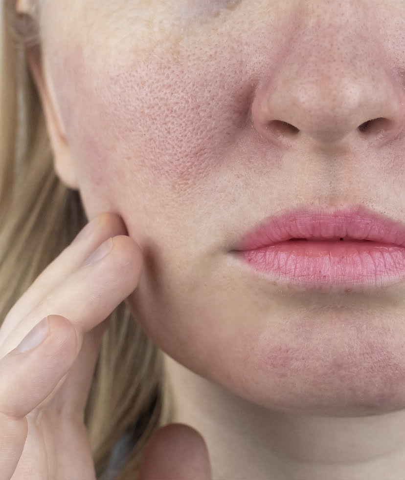 10 Tips From Dermatologists That Can Help You to Tighten Large Pores